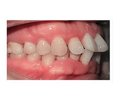 Trước điều trị