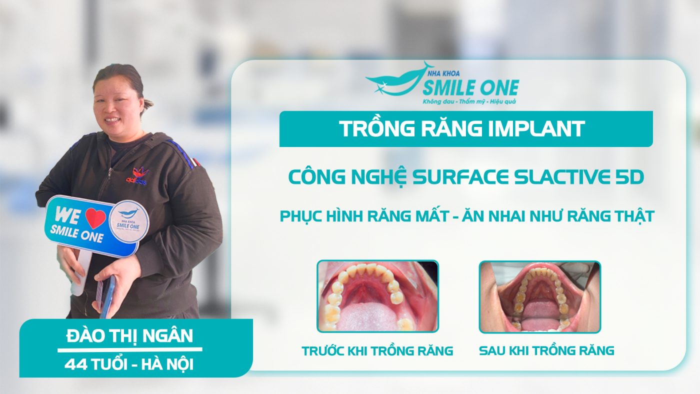 Ths Bs Nguyễn Tuấn Dương kết hợp bác sĩ BV Bạch Mai cấy Implant cho bệnh nhân tiểu đường, huyết áp cao